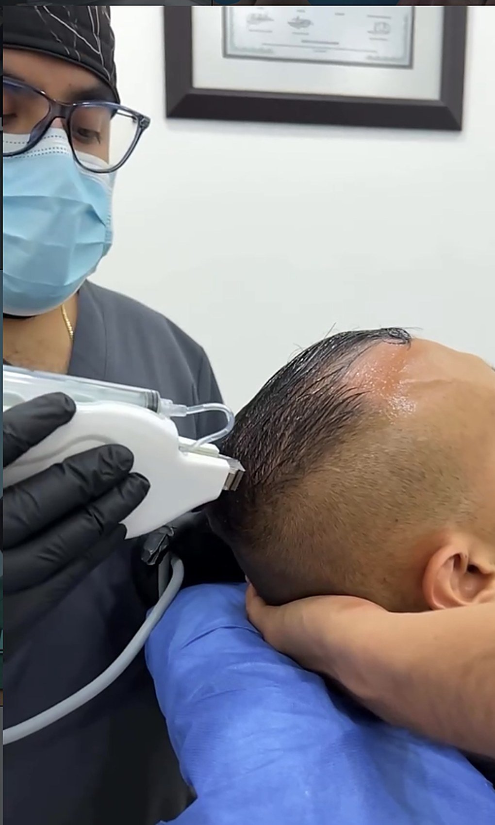 Dr. Andrés Osorio durante un tratamiento capilar